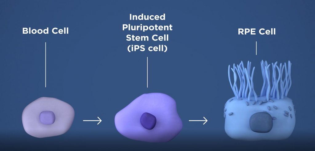 Stem Cell Treatments